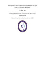 agenesia odontoiatrico trasposizione o pontevedra